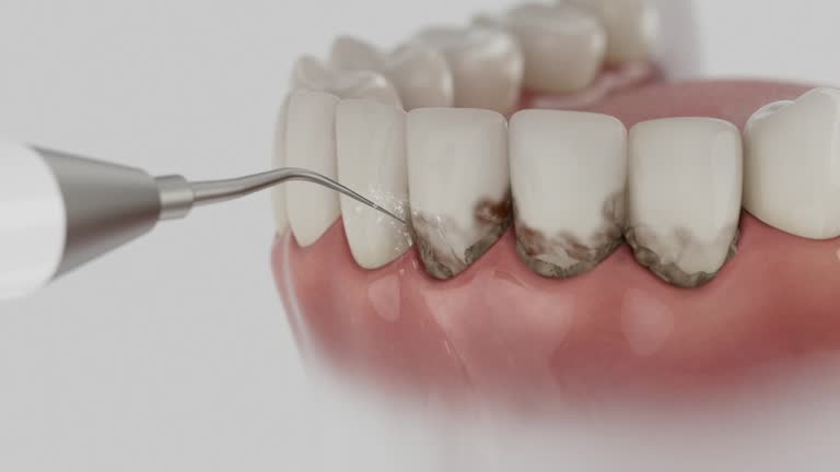 Trusted Dental Implants service in Rutland, VT - Dentist Open Now